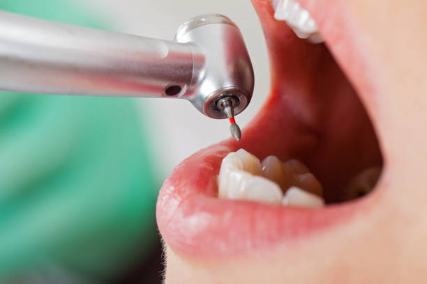 Best Emergency Treatment for Dental Infections or Abscesses in La Luz, NM